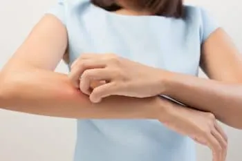 Skin Care Research advertisement AtopicDermatitis