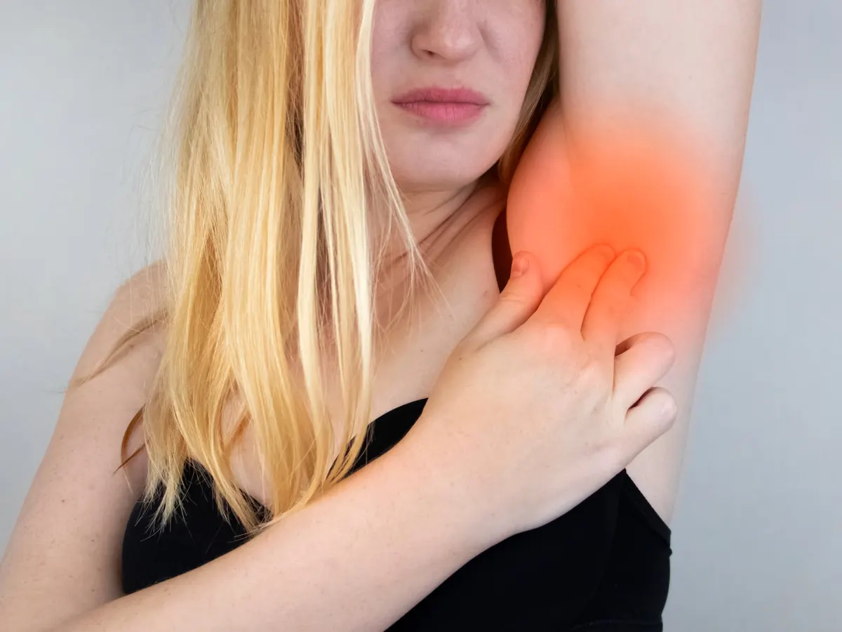 A woman raises one arm and touches her underarm, the area shaded red