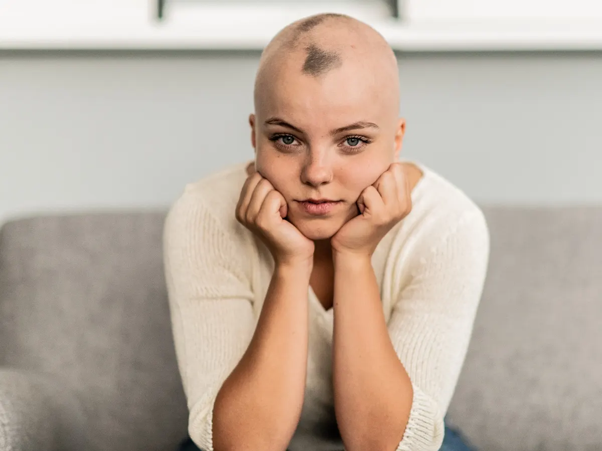 A young woman with a shaved head and a small patch of hair at the crown rests her chin on her hands