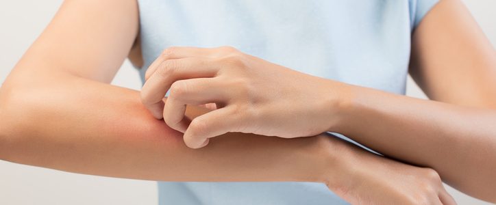 Itching on a arm of young woman