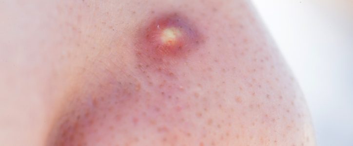Clinical Dermatology Boca Raton, FL