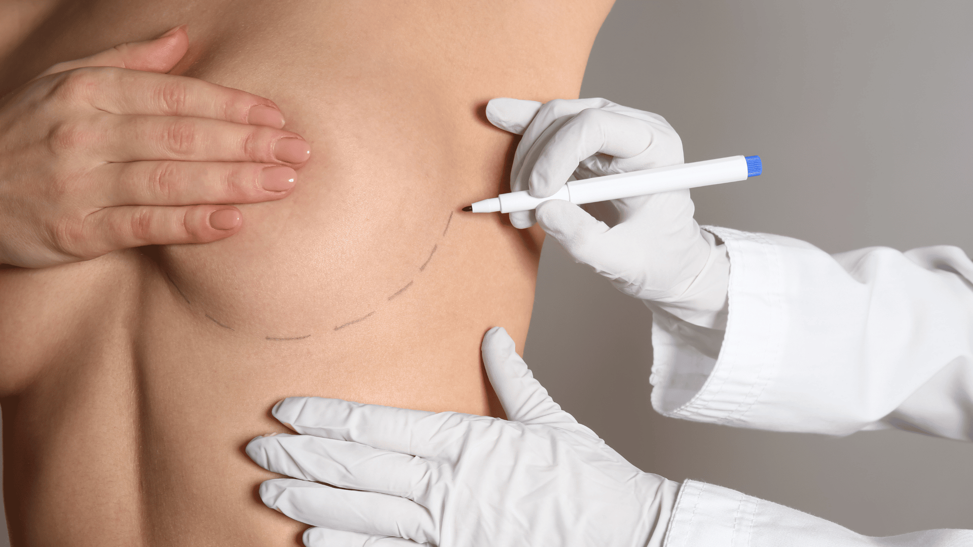 breast surgery