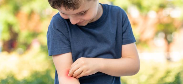 boy with eczema scratching his arm