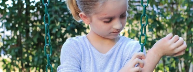 girl with eczema scratching her arm picture id1137613904