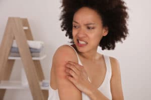 Woman Scratching an itch . Sensitive Skin, Food allergy symptoms, Irritation