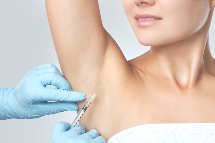 The doctor makes intramuscular injections of botulinum toxin in the underarm area against hyperhidrosis.