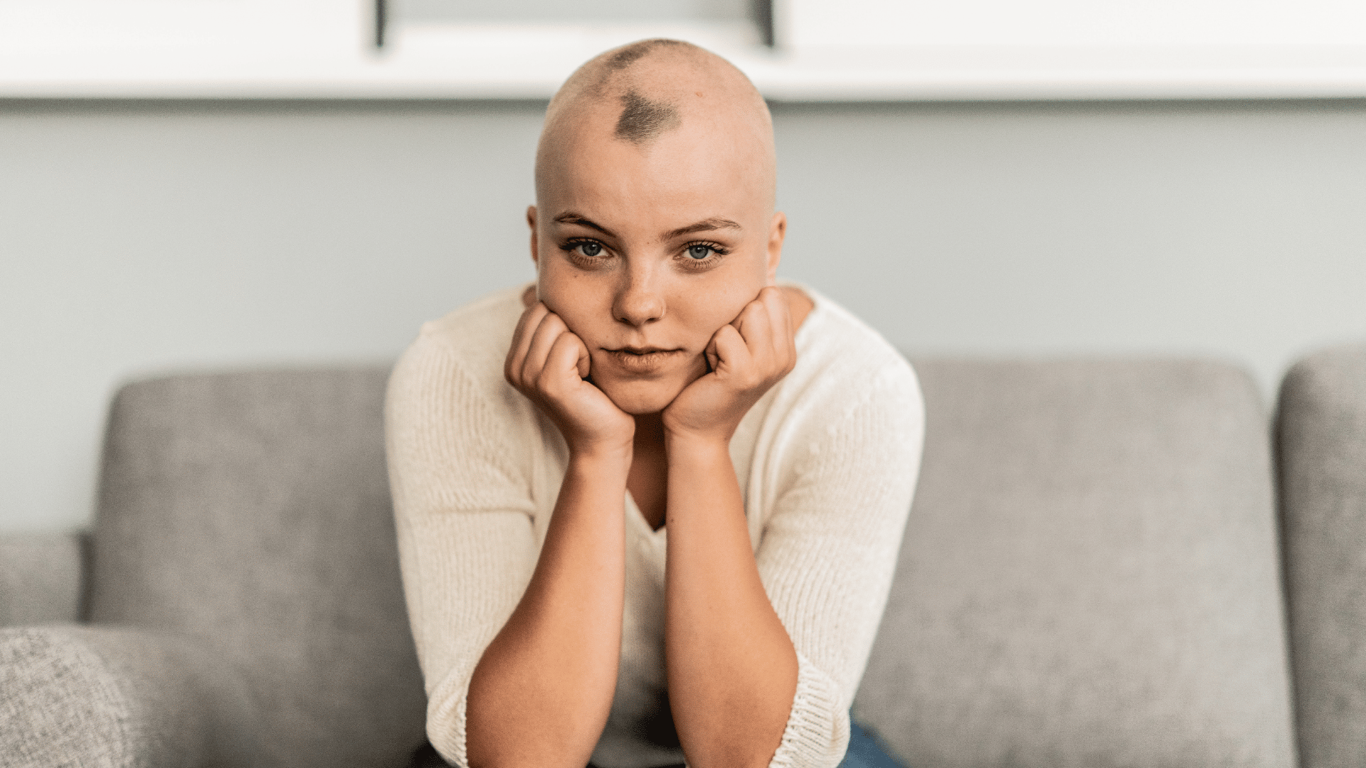 Alopecia Clinical Trial