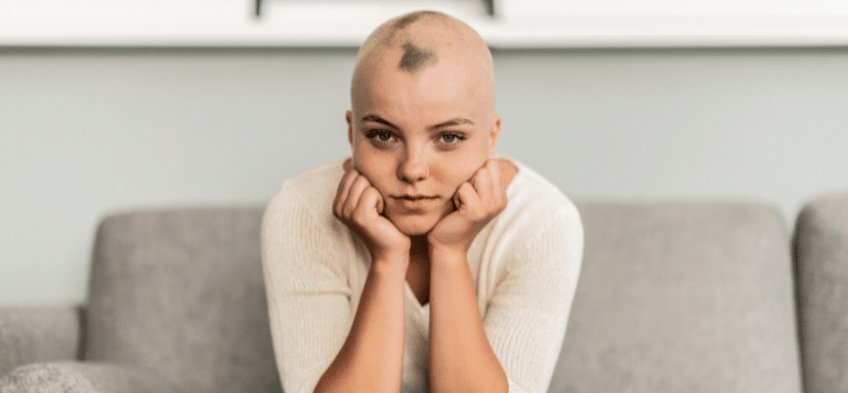 adolescent suffering from alopecia areata
