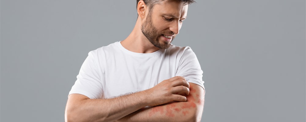 Annoyed middle-aged man in white t-shirt scratching itch on his arm