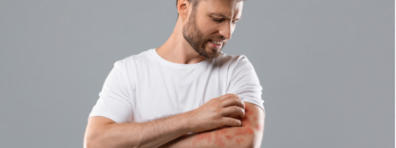 Annoyed middle-aged man in white t-shirt scratching itch on his arm